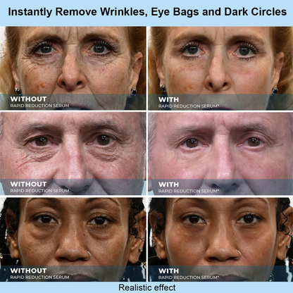 Instant Face Temporary Tightener – Instant visible results in 30 seconds