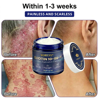 Made and Shipped from USA ✨Voresy® Biotin 10-in-1 Skin Restoration Cream 🍀