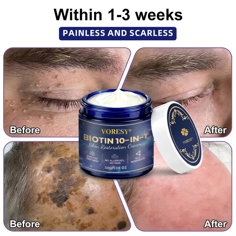 Made and Shipped from USA ✨Voresy® Biotin 10-in-1 Skin Restoration Cream 🍀