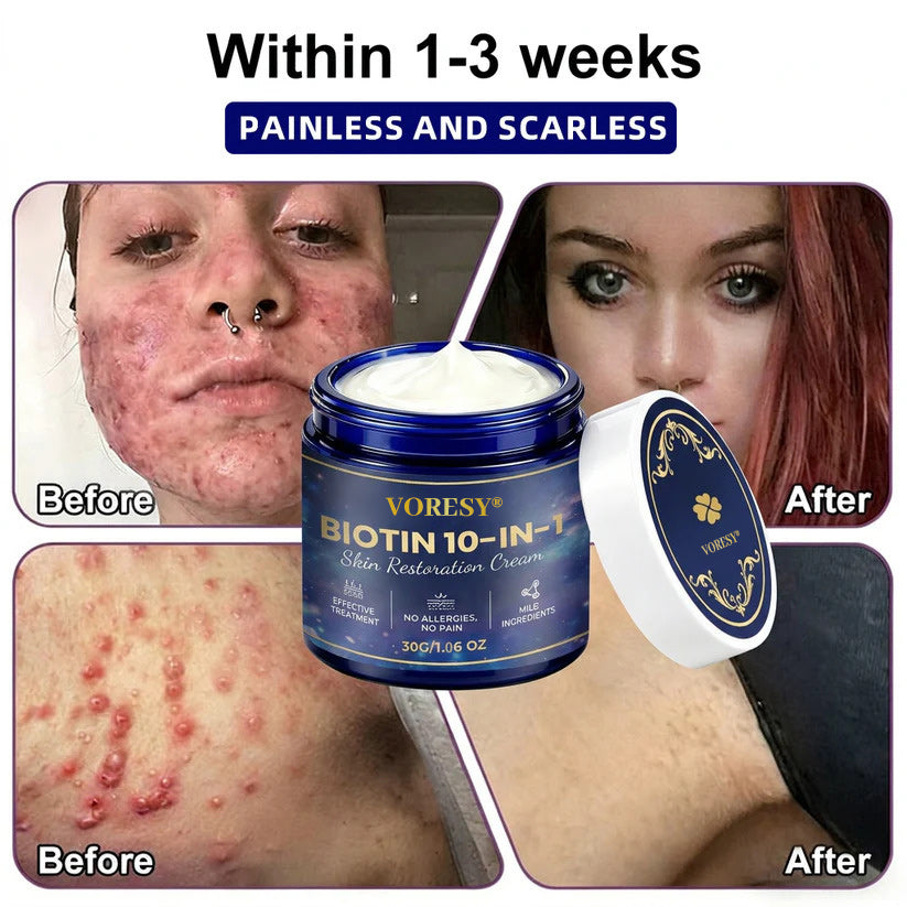 Made and Shipped from USA ✨Voresy® Biotin 10-in-1 Skin Restoration Cream 🍀