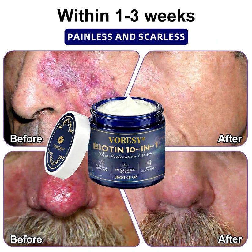 Made and Shipped from USA ✨Voresy® Biotin 10-in-1 Skin Restoration Cream 🍀