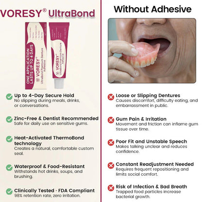 UltraBond Premium Denture Adhesive 🔥 FDA Certified (Clinically Proven 4-Day Hold for Secure, Comfortable & Zinc-Free Denture Fit 🦷)