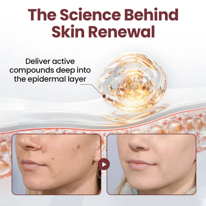 KeraErase Dual-Action Renewal Cream