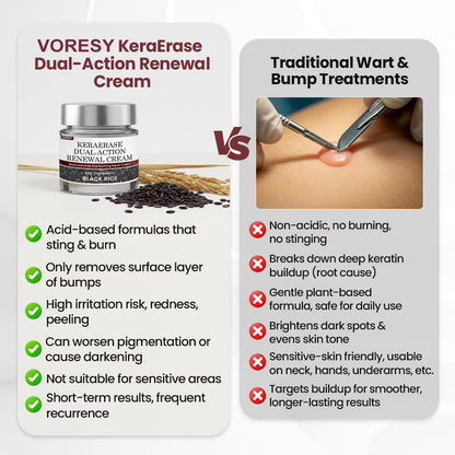 KeraErase Dual-Action Renewal Cream