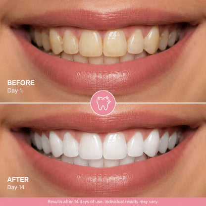 Tooth Armour Toothpaste Serum