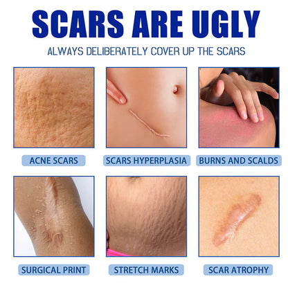 🔥Limited-time 60% sale--LUMIVO Scar Repair Cream — Smooth, Clear, Confident Skin