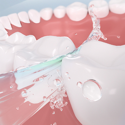 UltraBond Premium Denture Adhesive 🔥 FDA Certified (Clinically Proven 4-Day Hold for Secure, Comfortable & Zinc-Free Denture Fit 🦷)